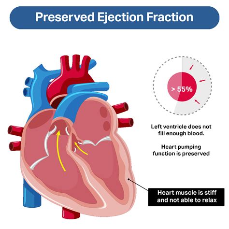 what does preserved ef mean.